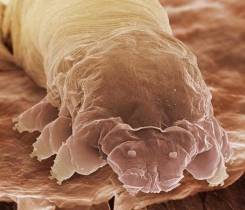 eyelash_mite