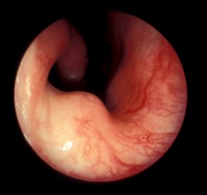 nasal-mucosa