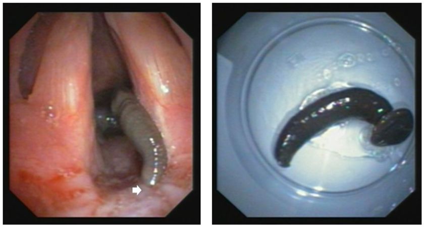 thoraxjnl-2017-211394-F1.large[1]