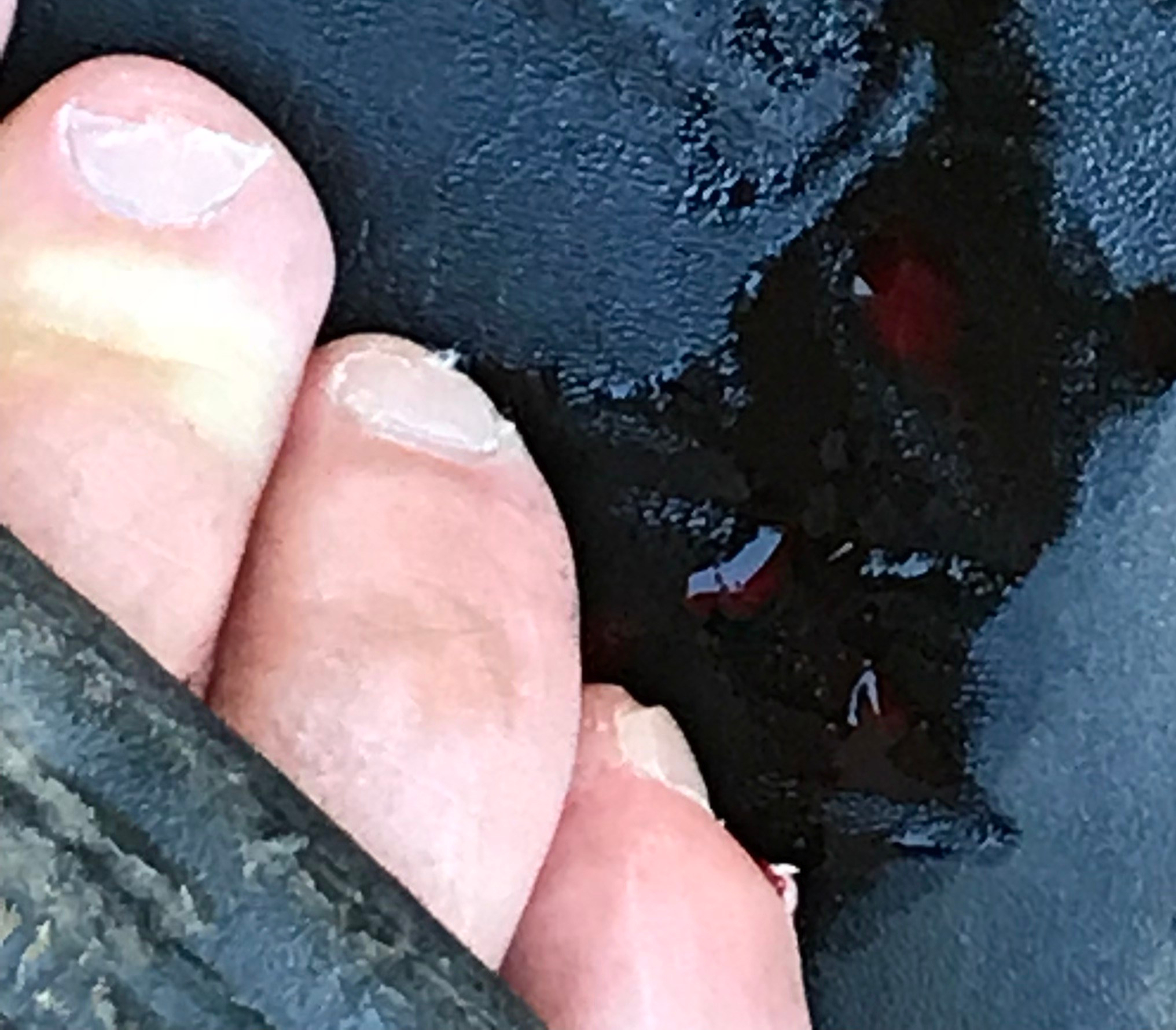 air nail protruding from pinkie toe