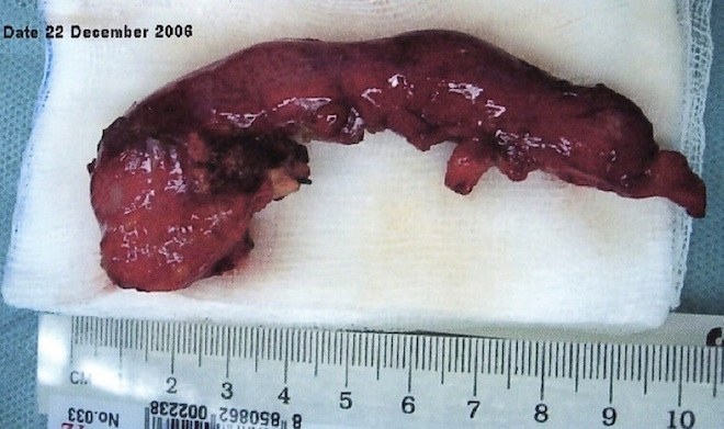 appendix